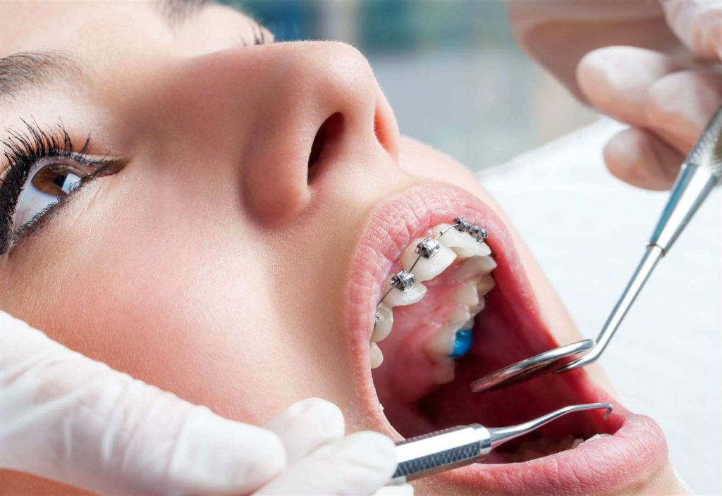 Find Orthodontist Near Me for Soreness In Mouth