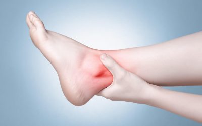 How Long Does a Sprained Ankle Take to Heal