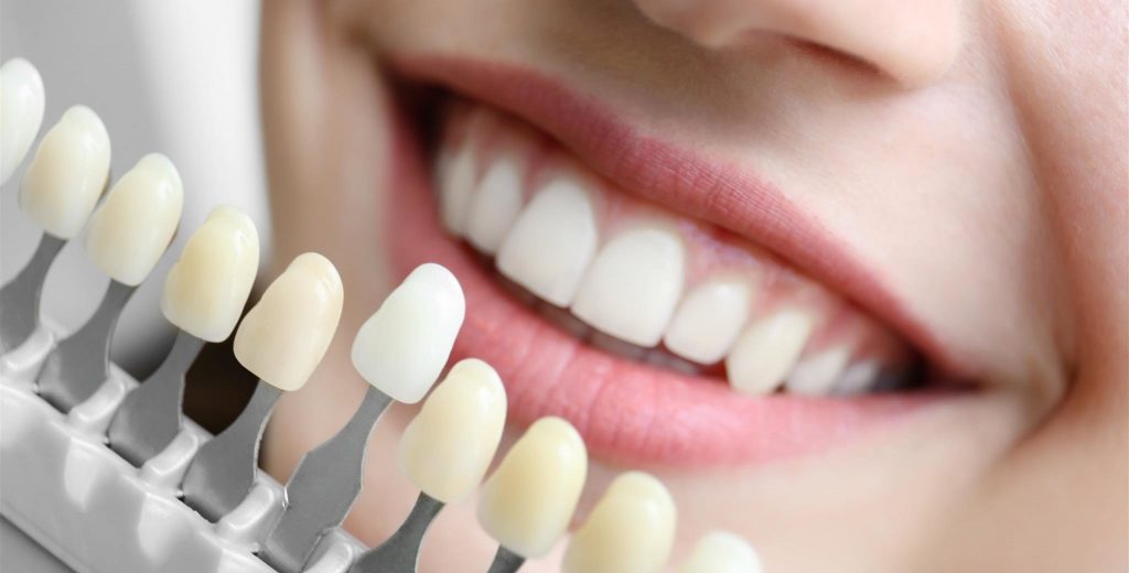tooth porcelain coatings